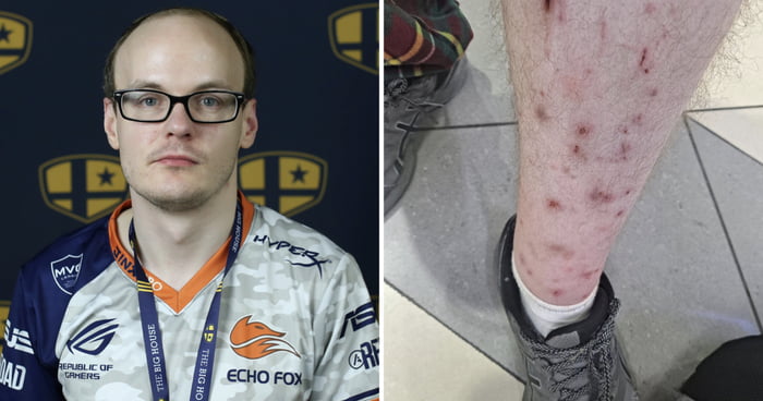 Super Smash Bros. Legend Mew2King Banned From Tournament After Bed Bug Fears Spark Concern