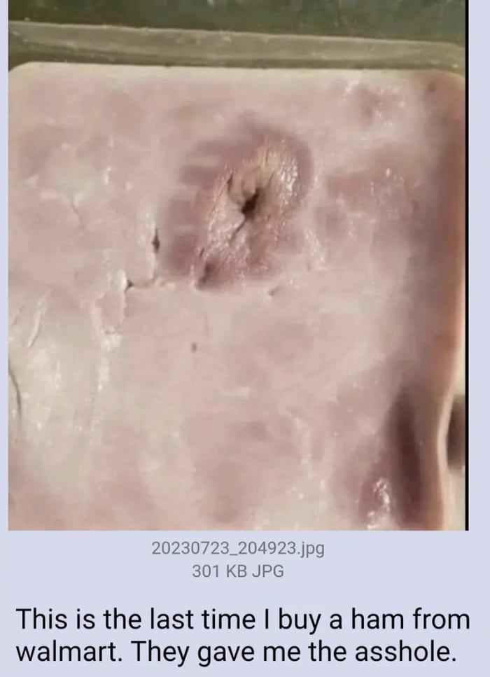 They gave him the asshole