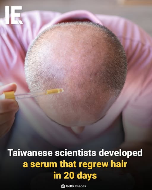 Good News Everyone !!! Researchers at National Taiwan University have created a topical serum made from monounsaturated fatty acids that triggered rapid hair growth in mice within 20 days by activating fat-cell signals beneath the skin.