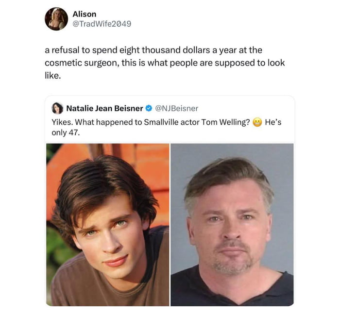 People age Natalie