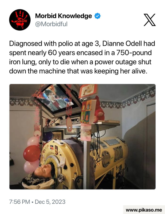 Imagine being alive like this