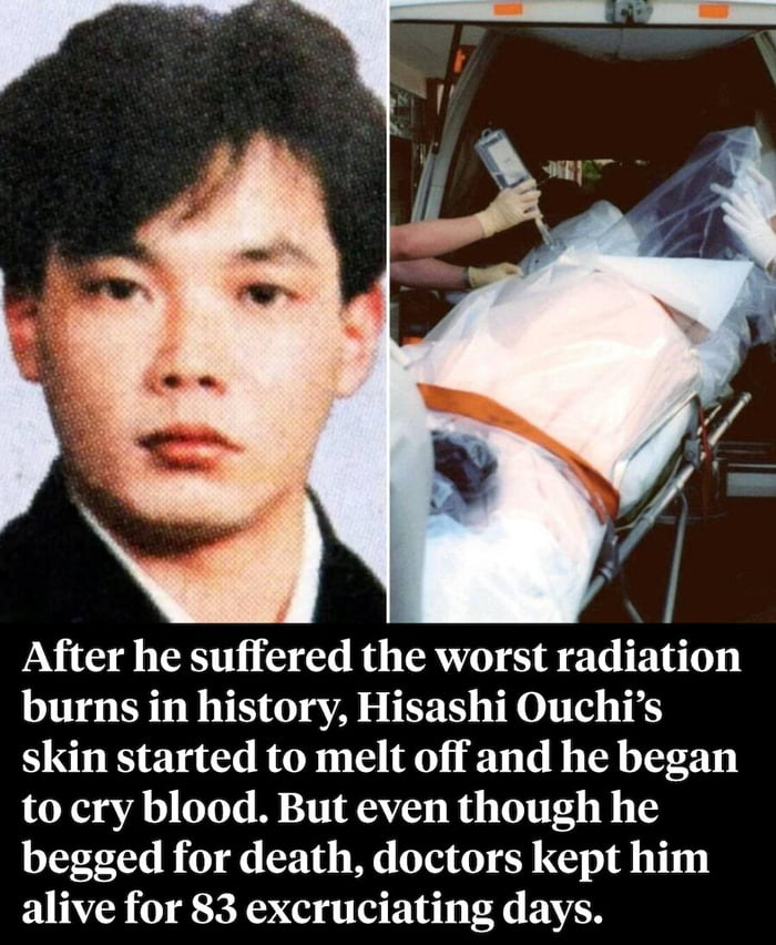 This has got to be the worst death in the history of mankind. Damn! Some of you degenerates might know about or seen that infamous cartel video. Probably the worst death recorded on video. Yeah, this is worse than that and for 83 days straight!