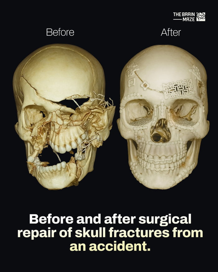 Dude became a Lego kit