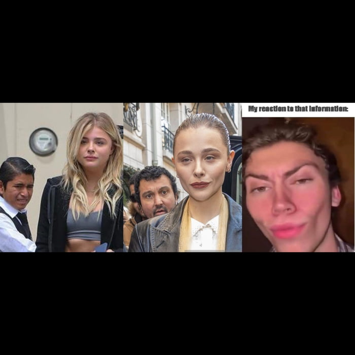 Why on earth do these celebrities think this kind of plastic surgery is attractive? On which alien planet?