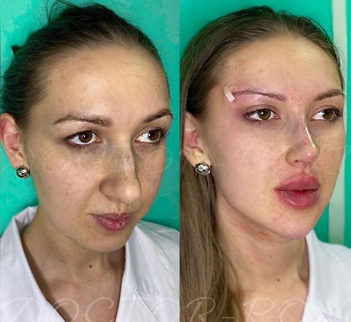 You are not ugly. You just don't have enough money...