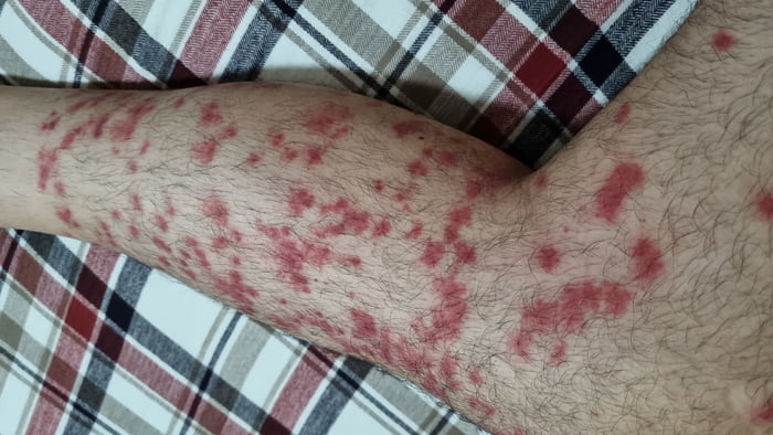 Any ideas? i went for a MTB ride yesterday in the middle of the bush?