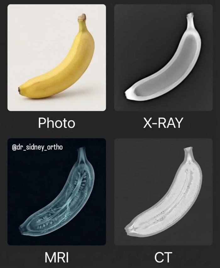 Banana for scan