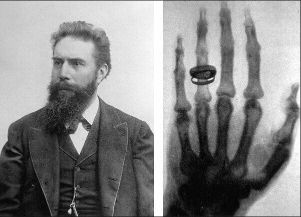 On 7th day of glorious White history month, we remember this glorious white guy, Wilhelm Conrad Röntgen, for his discovery of X-rays, which heralded the age of modern physics and revolutionized diagnostic medicine. His discovery helped doctors correc