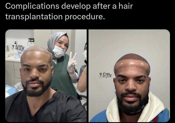From a hair transplant to Megamind