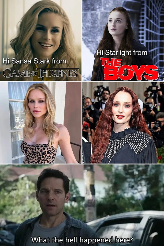 I know stargirl been doing awful surgery, but wtf happened to Sansa?!