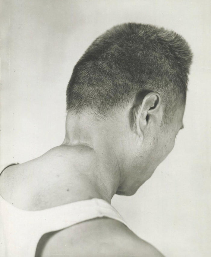 A filipino survivior of the manila massacre shows where a japanese officier tried to behead him