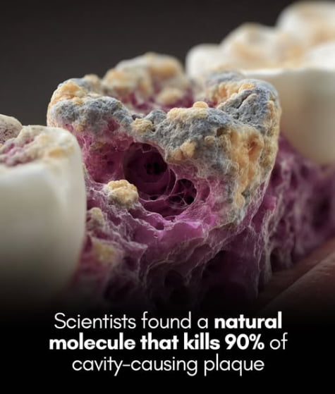 Broccoli Molecule Kills 90% of Cavity Bacteria