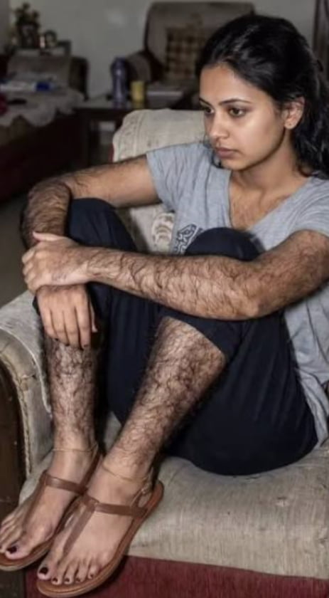 Would you date a woman with body hair