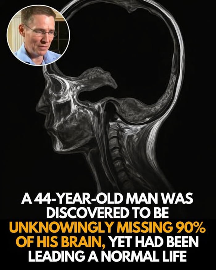 Living life on easy mode with 10% brain power