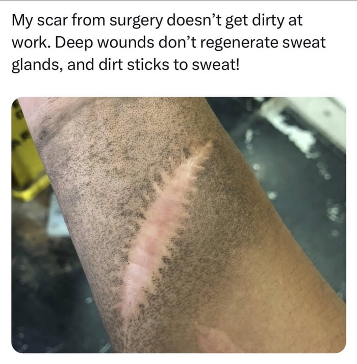 Dirt won't stick to my heart