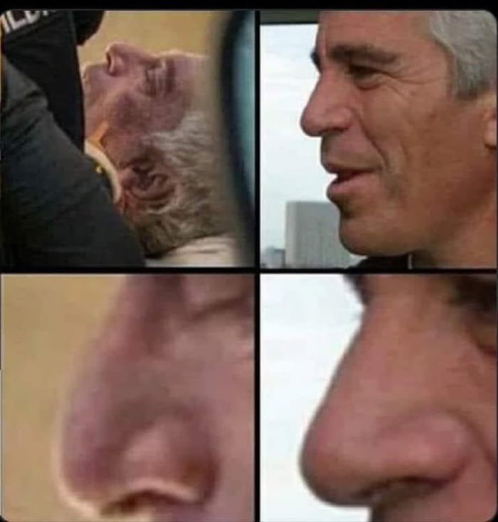 Nice to see Jeffrey Epstein got a nose job in prison so he could kill himself more stylishly.
