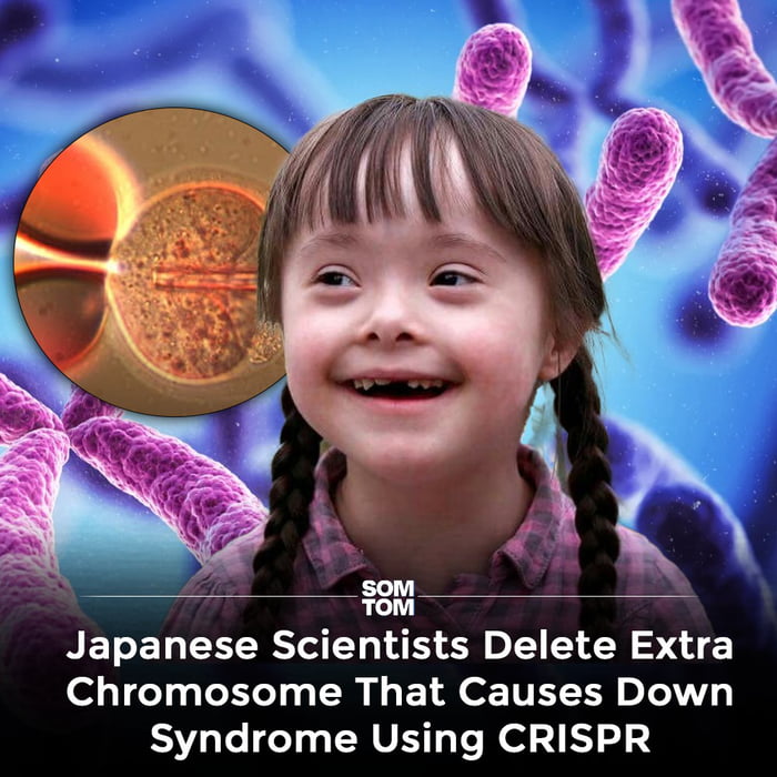 Great achievement! Also people with down syndrome do not live as long as long as a healthy person.