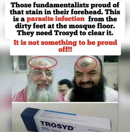 Zebibah is a callus on the forehead present in Muslims, mainly in Egypt. It is also known as the "devout sign" because it shows "how much they're praying". They believe that on the Day of Resurrection, it fluoresce with an immense white light.