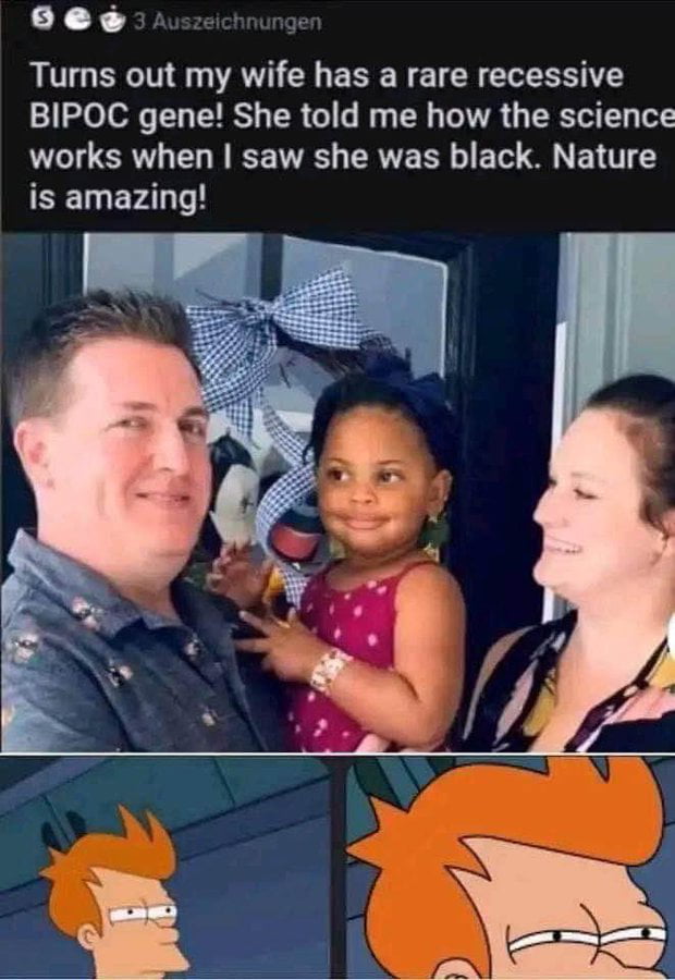 Its a rare condition btw