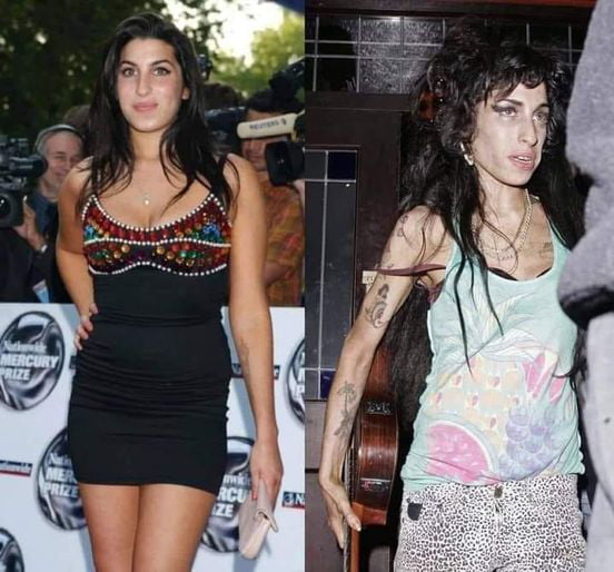 Amy Winehouse Before and After