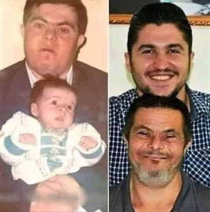 Father with Down syndrome who worked in a factory for 25 years and raised his son to become a doctor