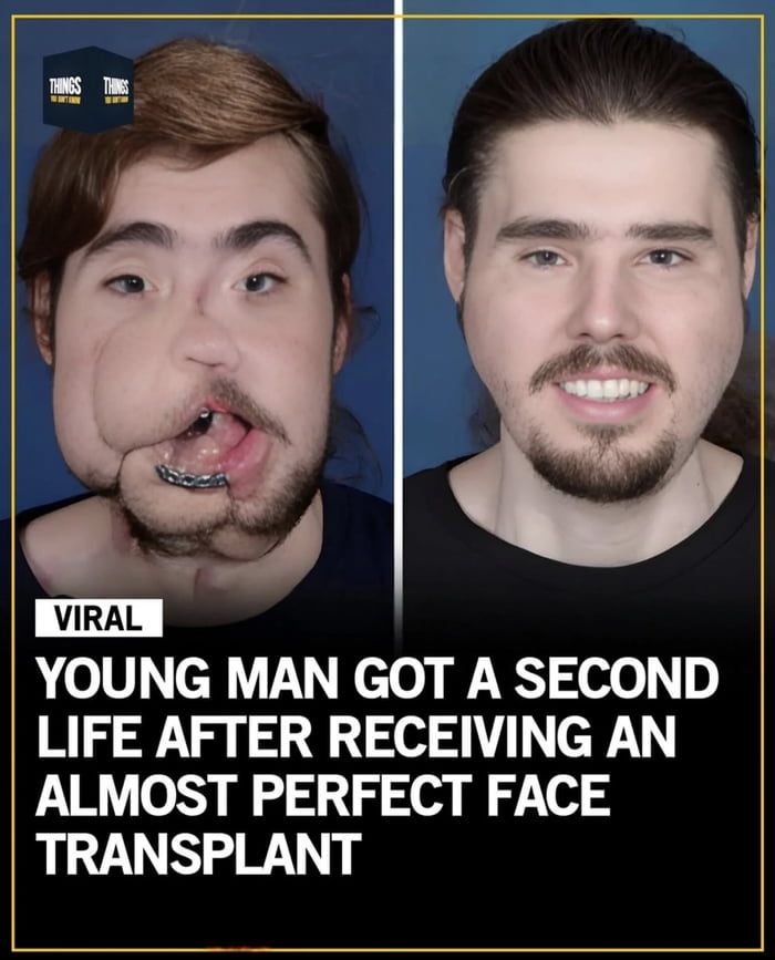 The Marvels Of Modern Medical Science