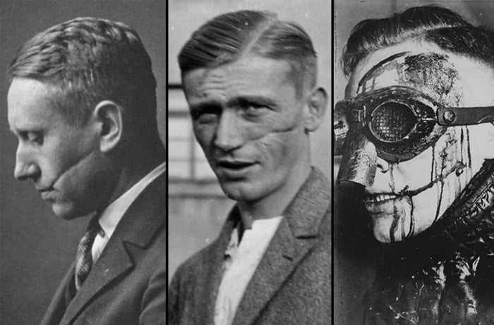 Facial scars signified honor. Rare photos of the German tradition of sword duels.