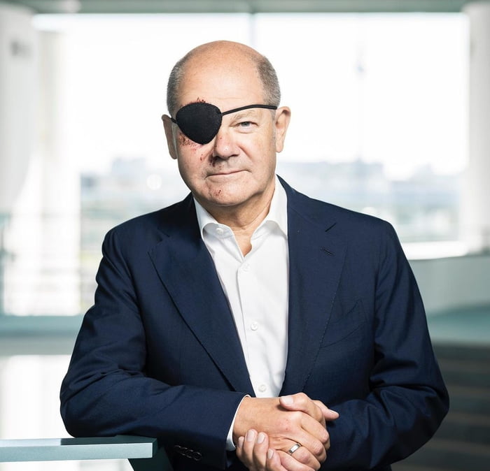 The German Chancellor fell and hurt his eye while jogging. Now he has to wear an eyepatch. His reaction: "I'm eager to see all the memes about that"