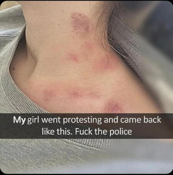 Oh...that's not ....