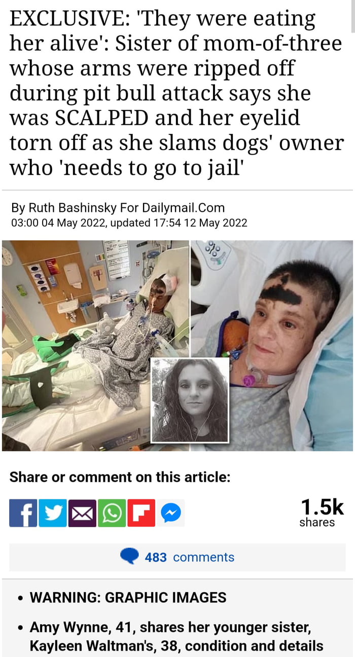 Woman had her arms ripped off and colon torn out in savage pit bull attack