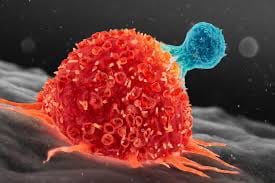 Bee venom eliminates 100% cancerous cells in 60 mn in a breast metastatic cancer.