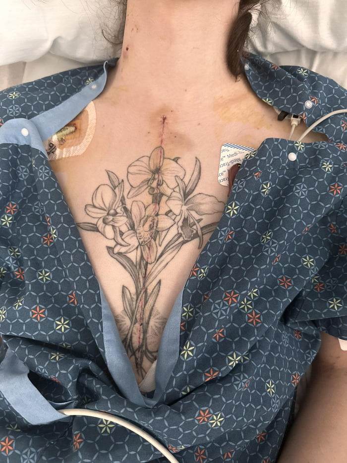 Surgeon kept tattoo aligned