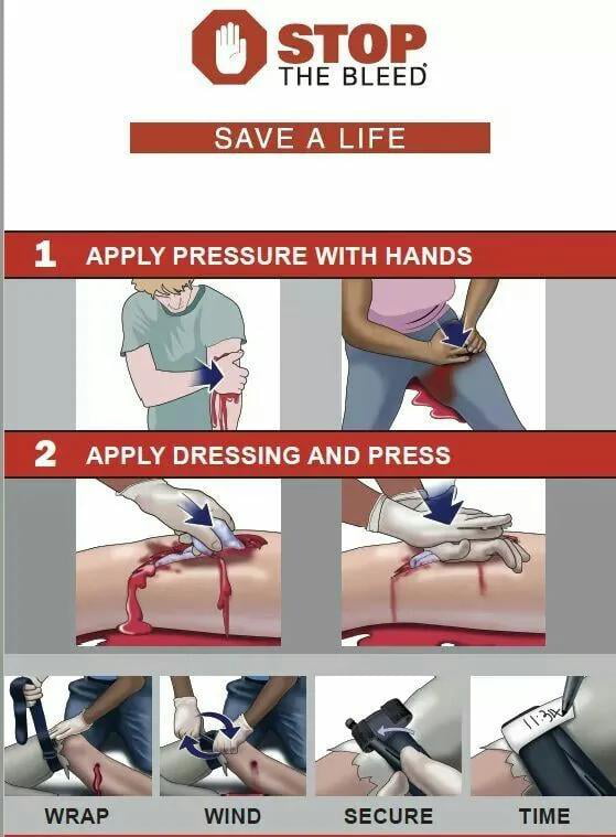 Steps to control bleeding