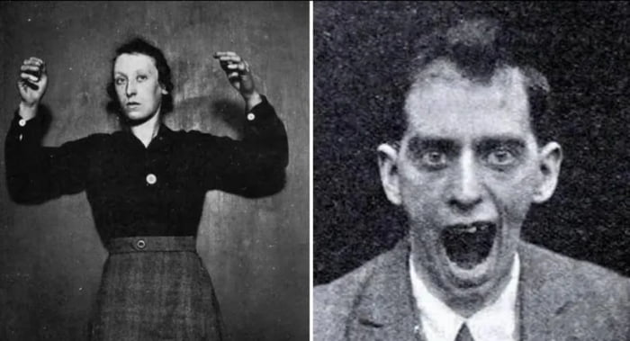 “Encephalitis lethargica remains one of the most haunting medical mysteries of the twentieth century, a disease that swept across the world and then vanished as suddenly as it appeared.”