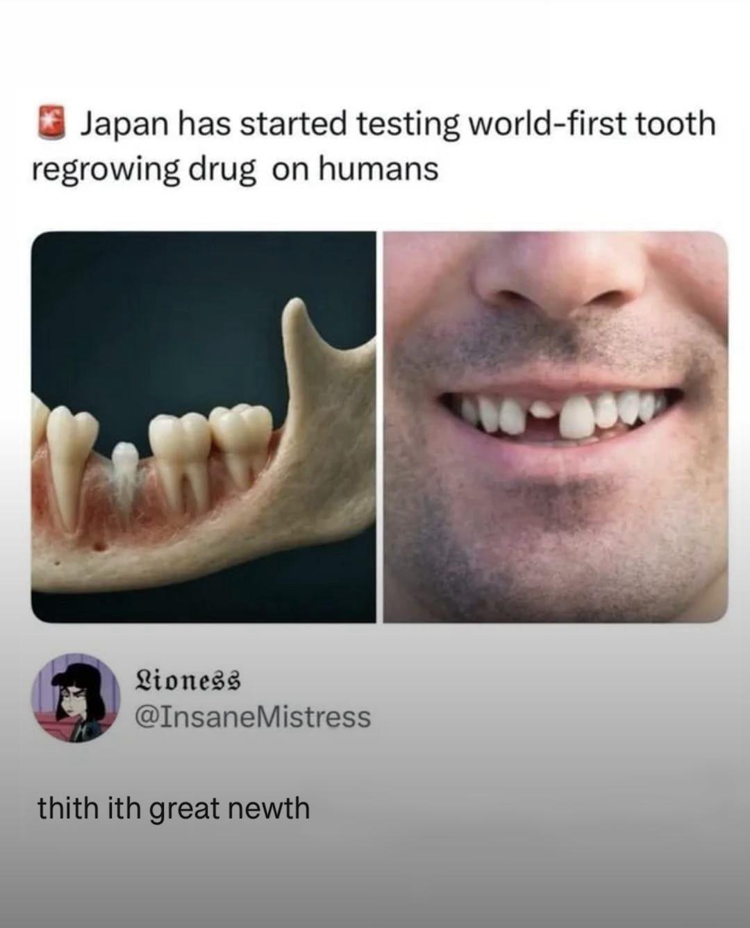 thith ith phenomenal newth