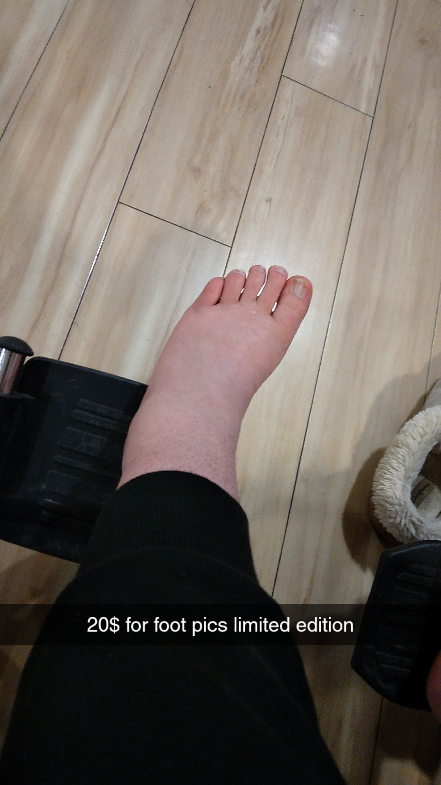Breaking my ankle hasn't lessen my genius humour