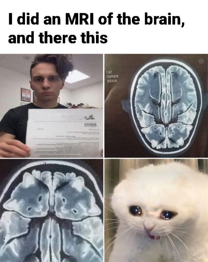 Bilateral chronic cat