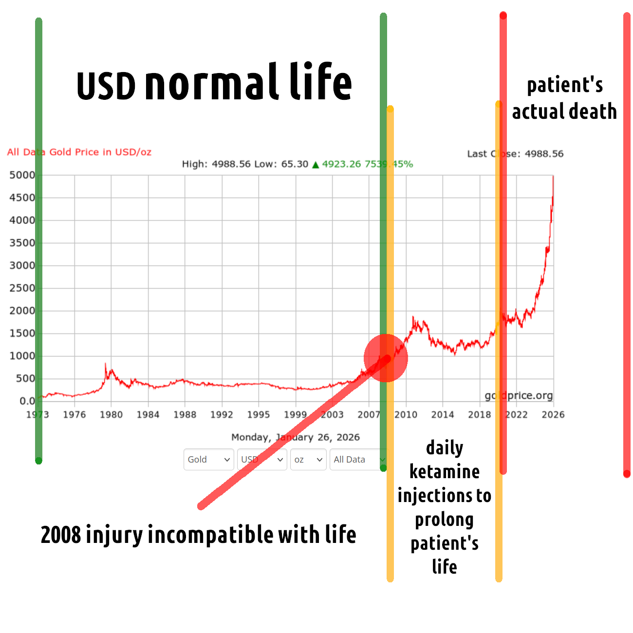 Patient's heart has stopped