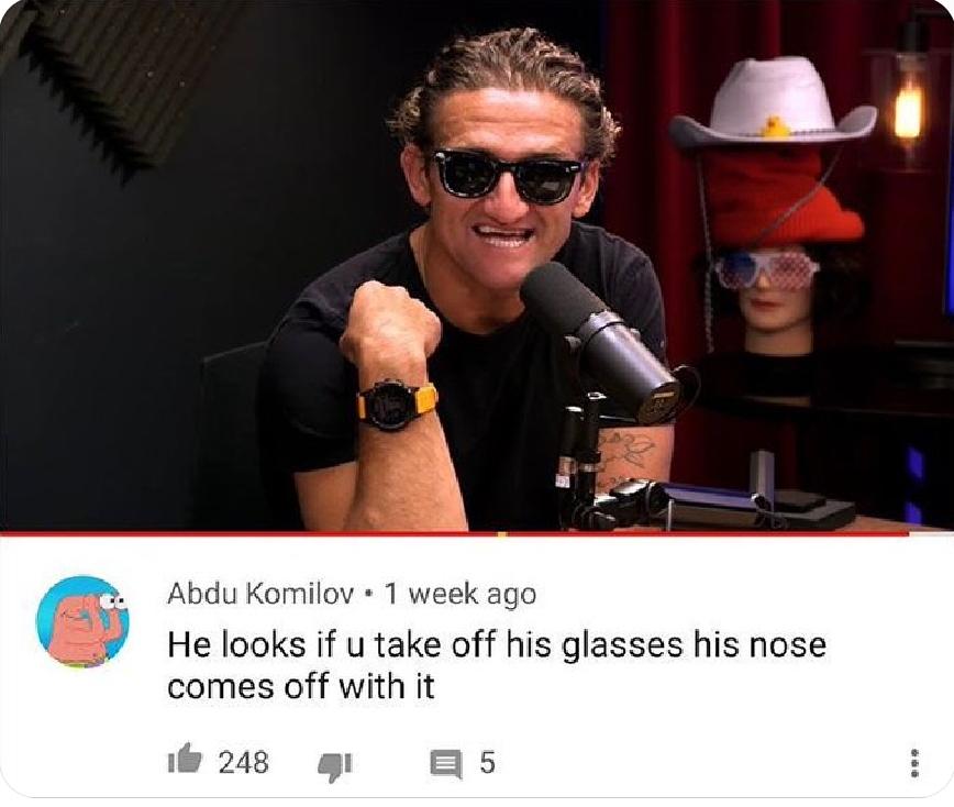 The Ultimate Spy Disguise 🥸
