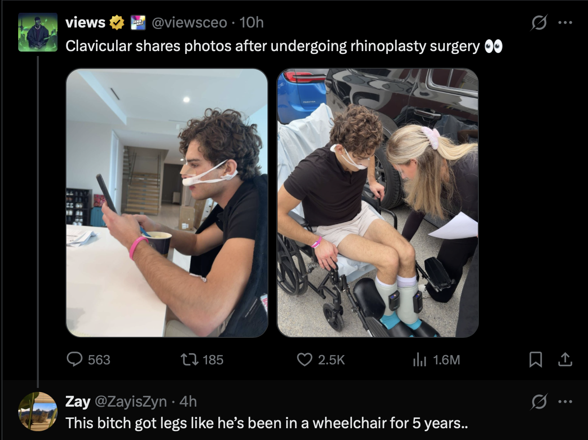 He's got wheelchair legs