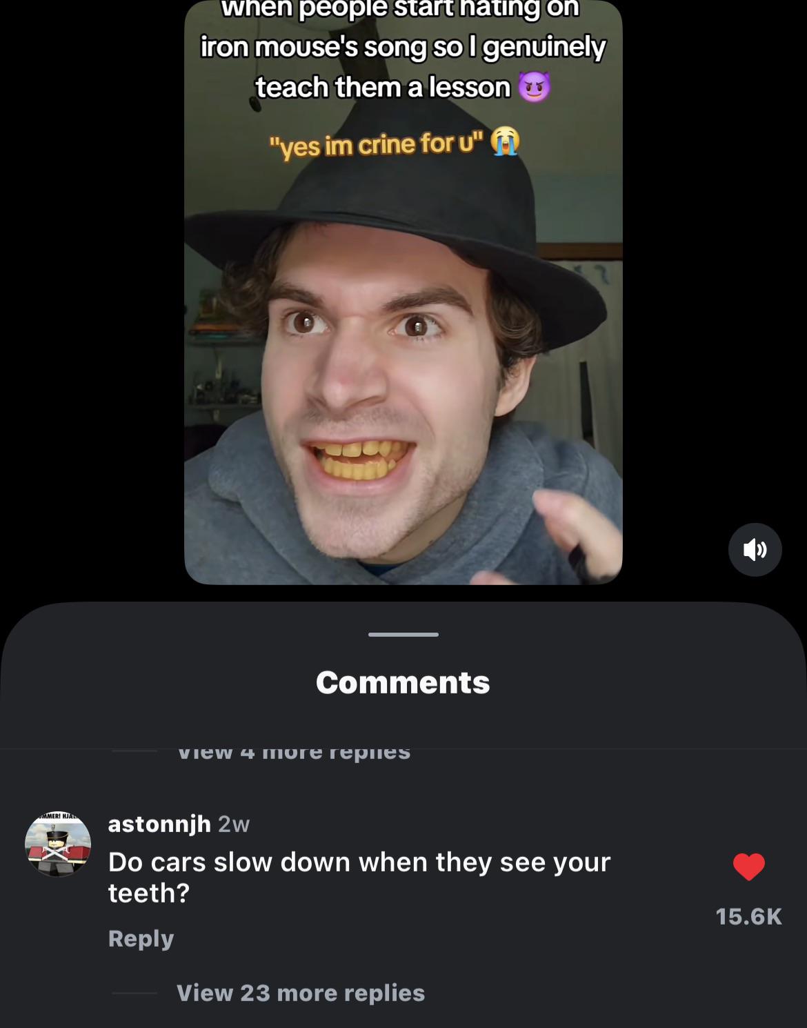 I hope he dyes his teethers with a sharpie and they're not actually like that 🙏🙏🙏🙏