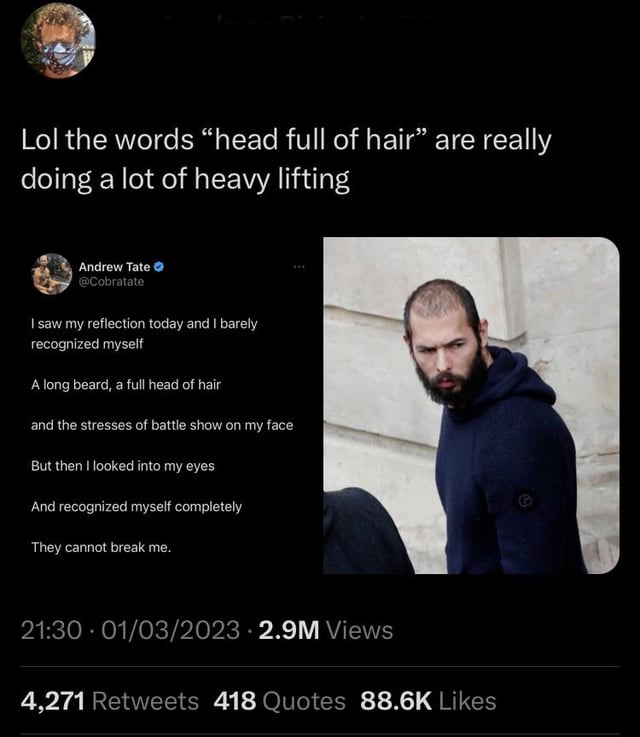 That’s definitely not a “full head of hair”