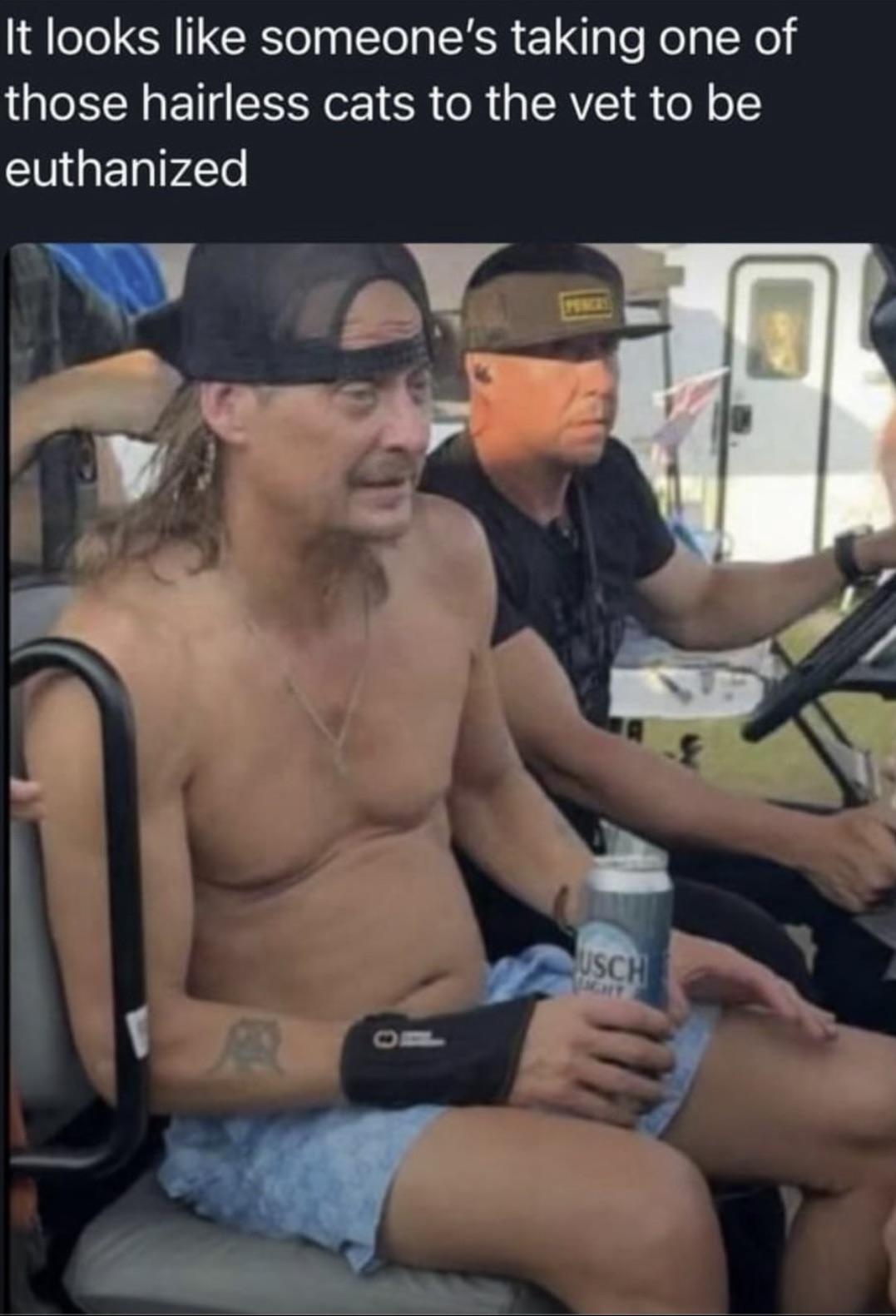 Kid Rock ain’t looking so good