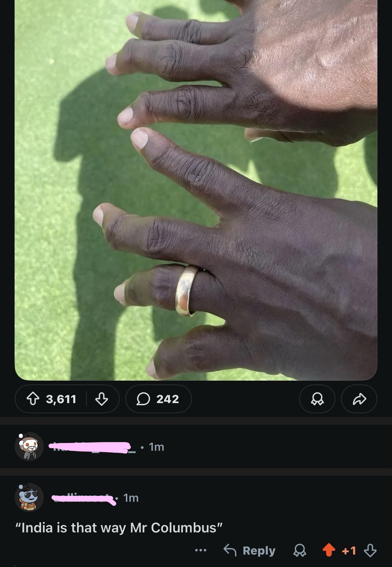 “NFL player's fingers after playing for 14 seasons”