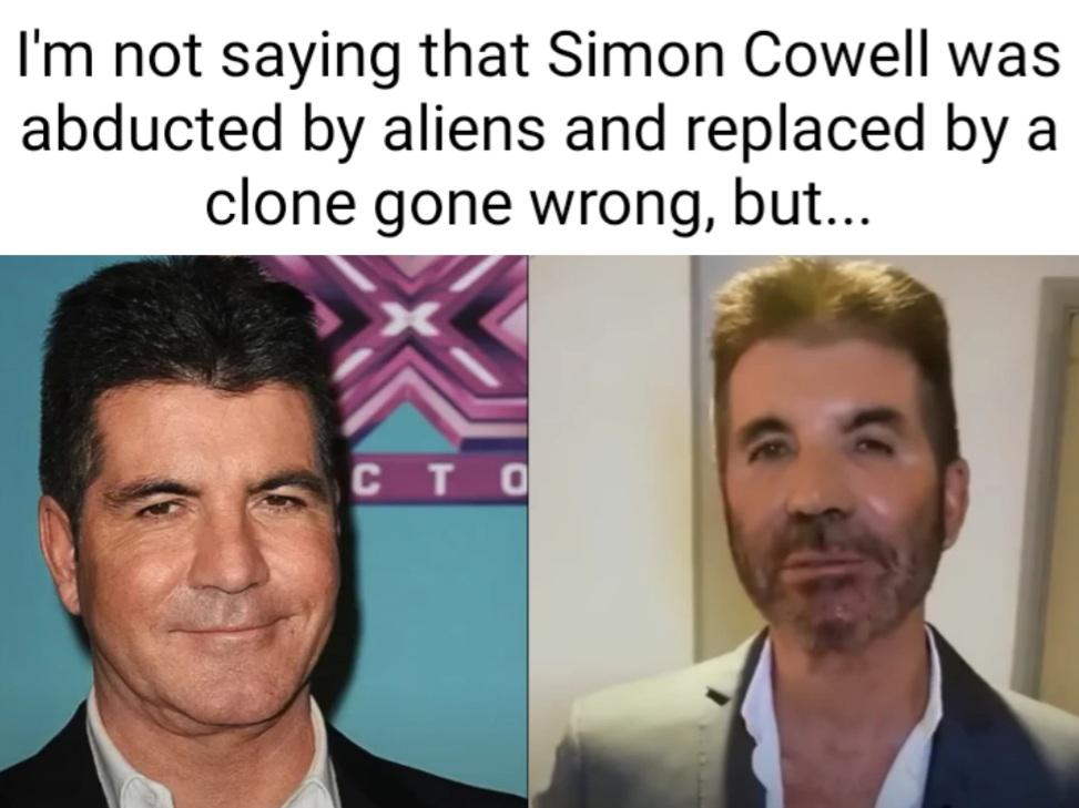 What happened to Simon Cowell?