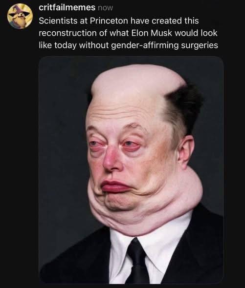 Elon Musk Loves Gender-Affirming Surgery 💖